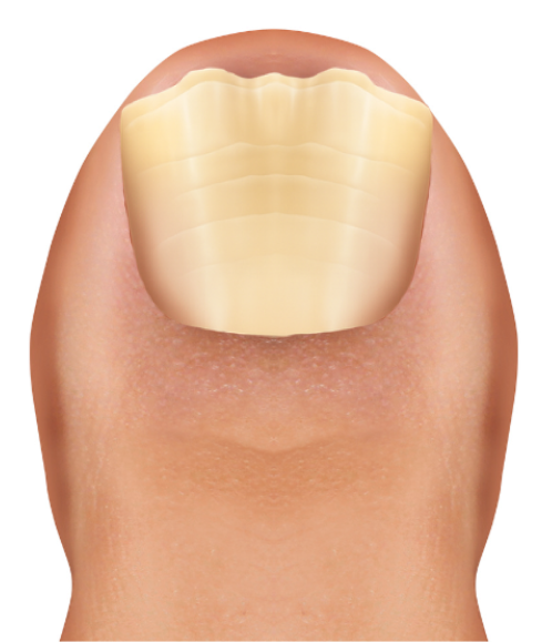 After image
