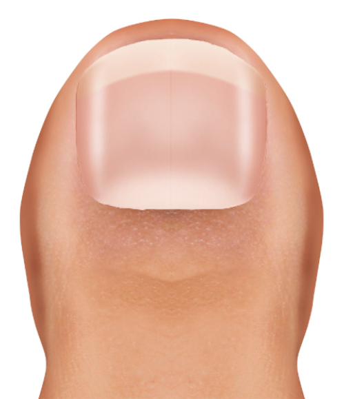 Before image